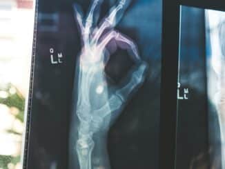 health insurance